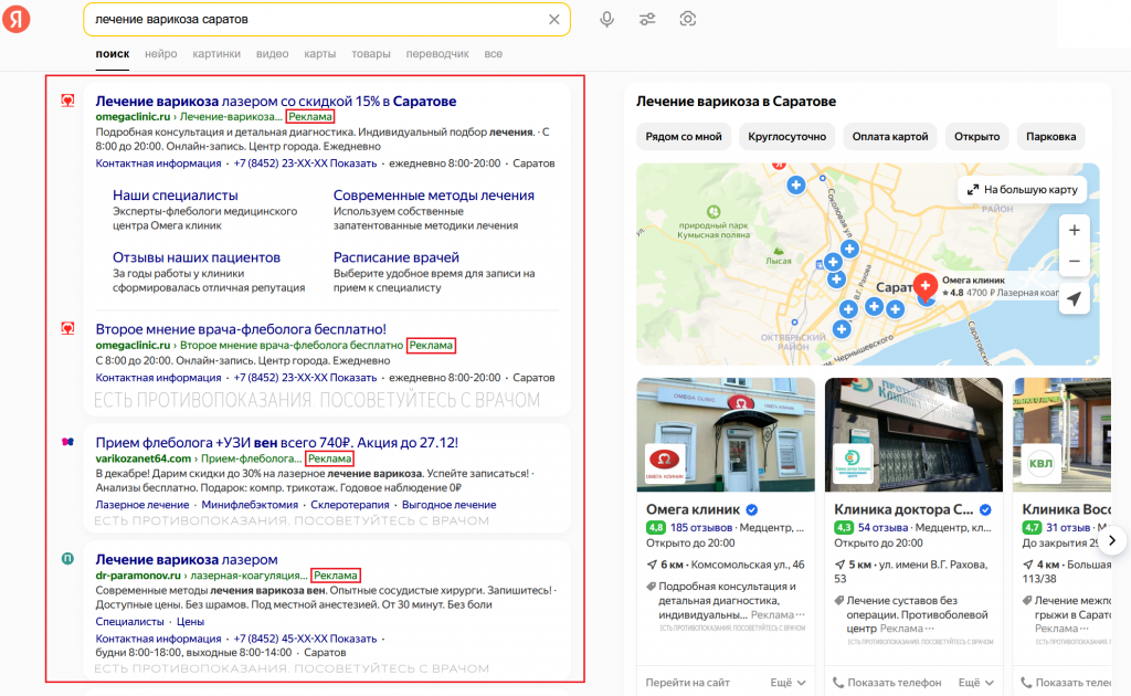 Контекстная реклама лечение варикоза выдача
